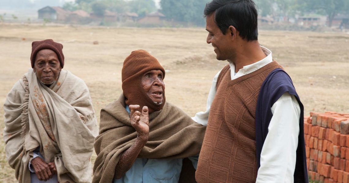 Bakari, a leprosy patient, became shunned by family and friends, the word "leprosy" stripped his dignity until an encounter with a GFA worker.
